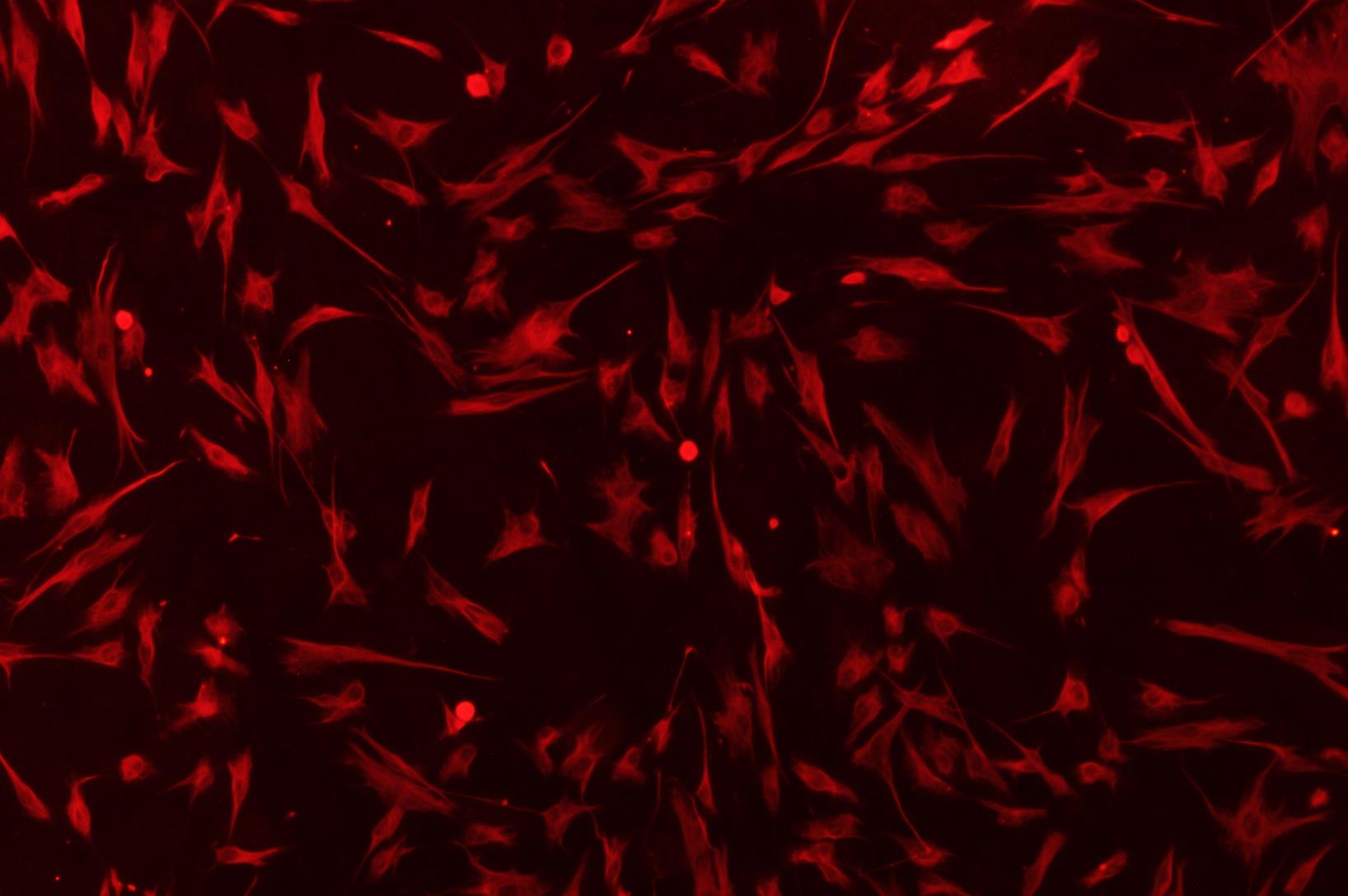 2-f.tif HHDPC;人毛乳头细胞(原代细胞)